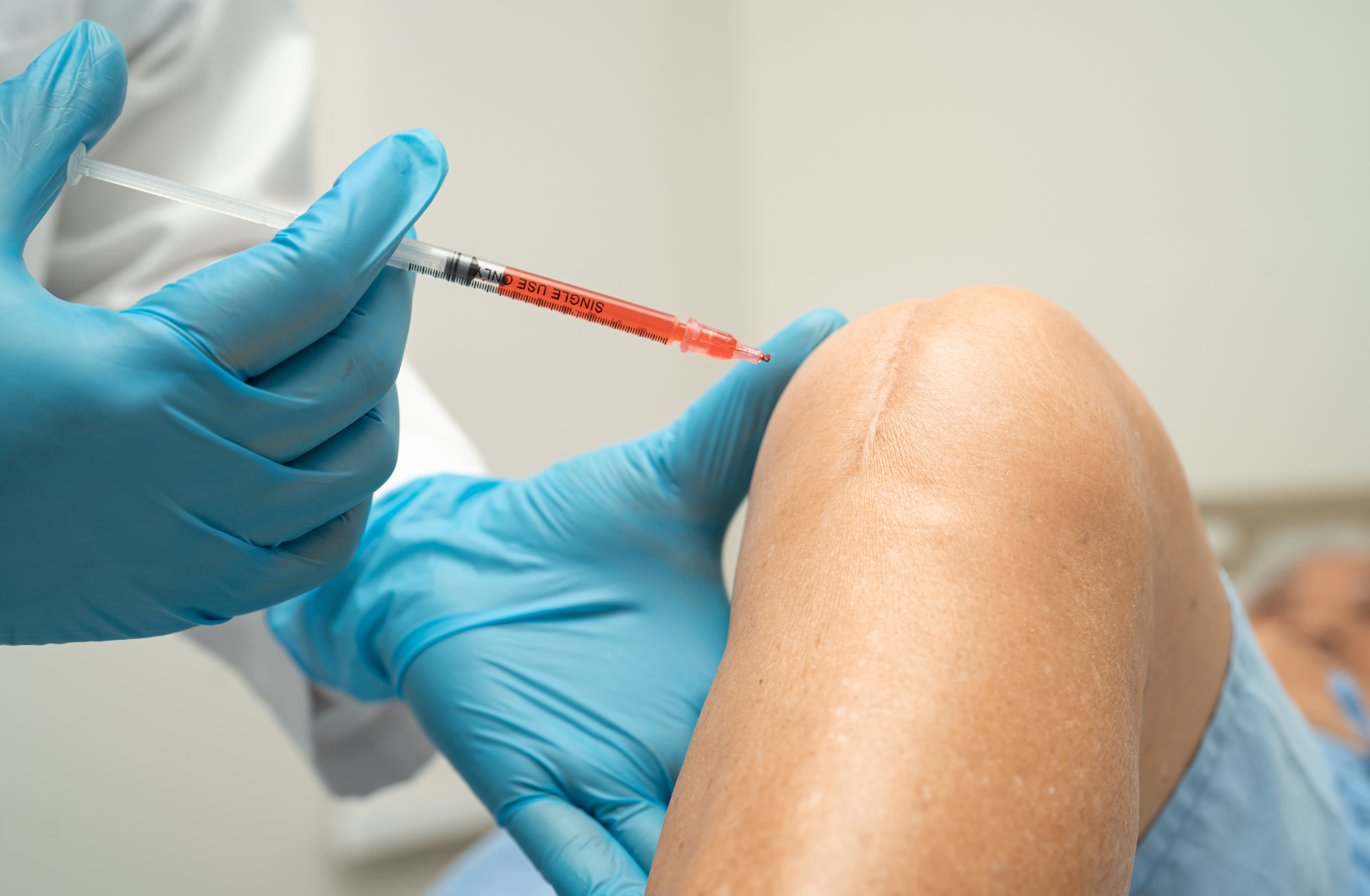 Lee más sobre el artículo Plasma Rico en Plaquetas en Traumatología