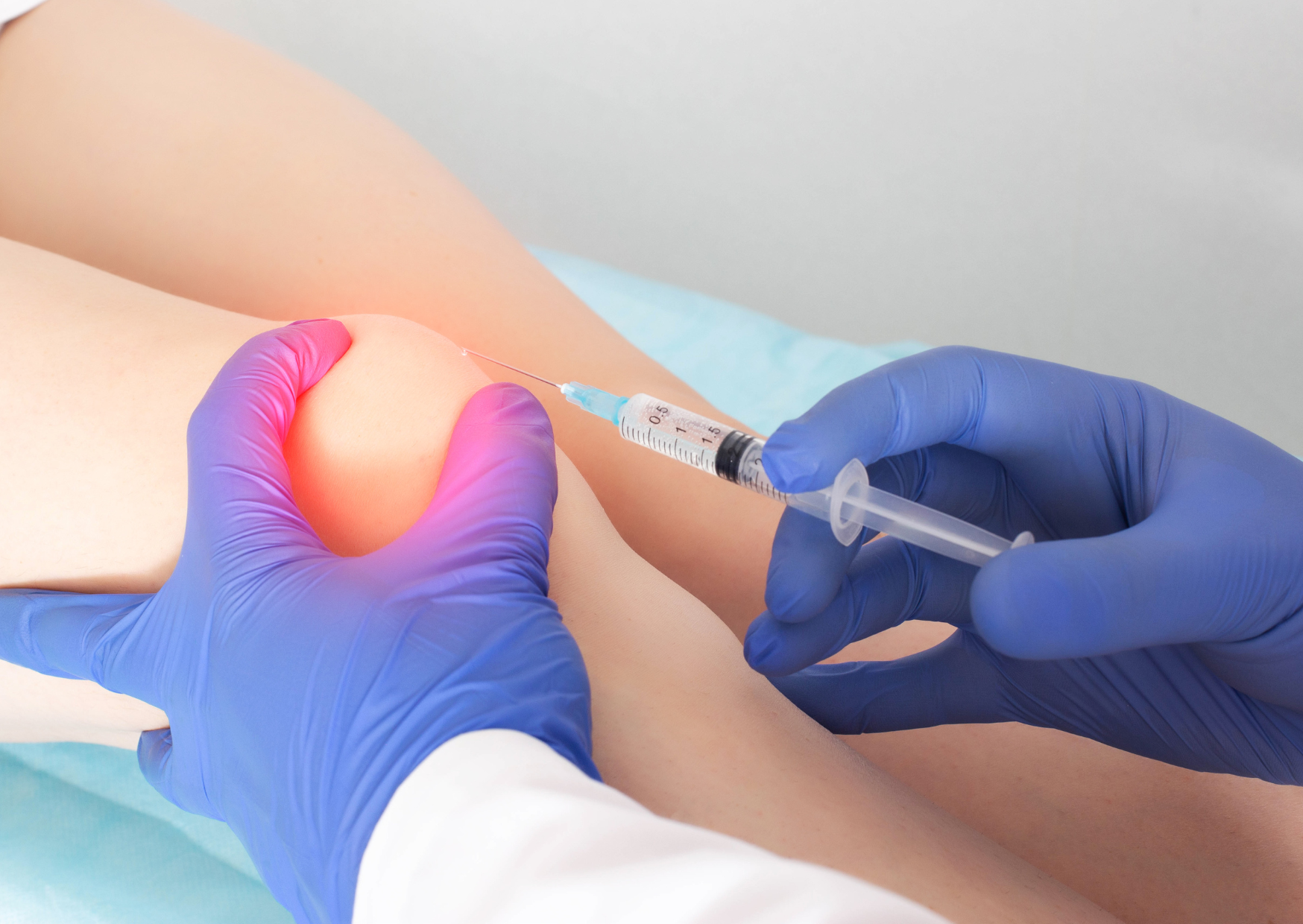 Lee más sobre el artículo El ácido hialurónico en lesiones de rodilla