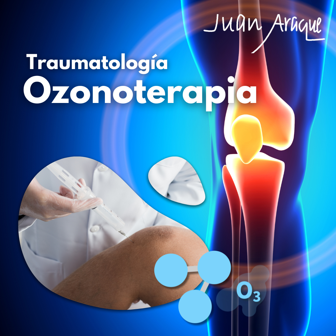 Lee más sobre el artículo La Ozonoterapia en Traumatología