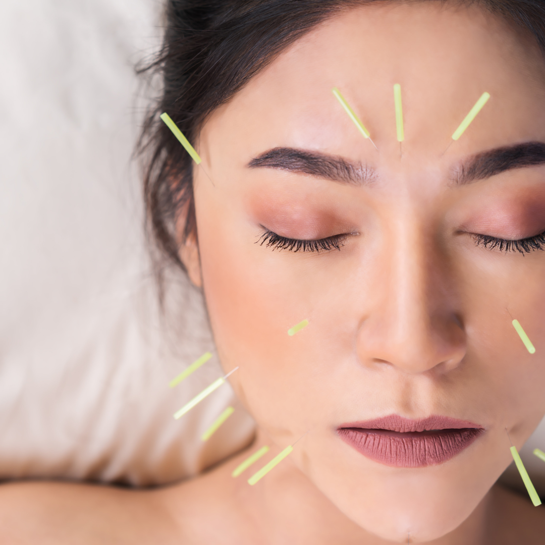 Lee más sobre el artículo La Acupuntura contra el dolor y la ansiedad